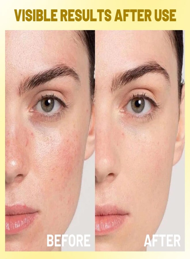 IREV Deep Vitamin C Capsule Face Moisturizer, Moisturizing Facial Cream, Transparent Gel for Radiant Skin, Hydrating Night Face Skin Care, Jelly Cream for Dull, Uneven Tone 4.9 OZ - Image 3